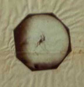 Fotomicrografia del vibrió colèric, del Dr. Jaume Ferran, 1886
